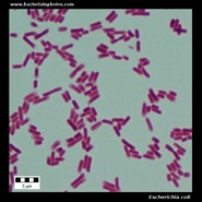 escherichia coli under microscope